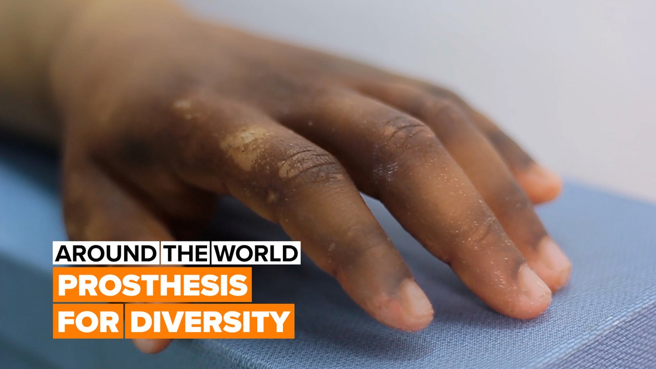 Synthetic body parts for diversity