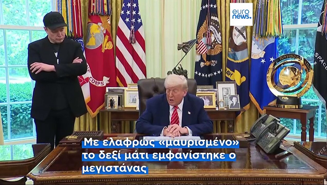 Ίλον Μασκ: Μαυρισμένο μάτι, ένα «χρυσό κλειδί»...