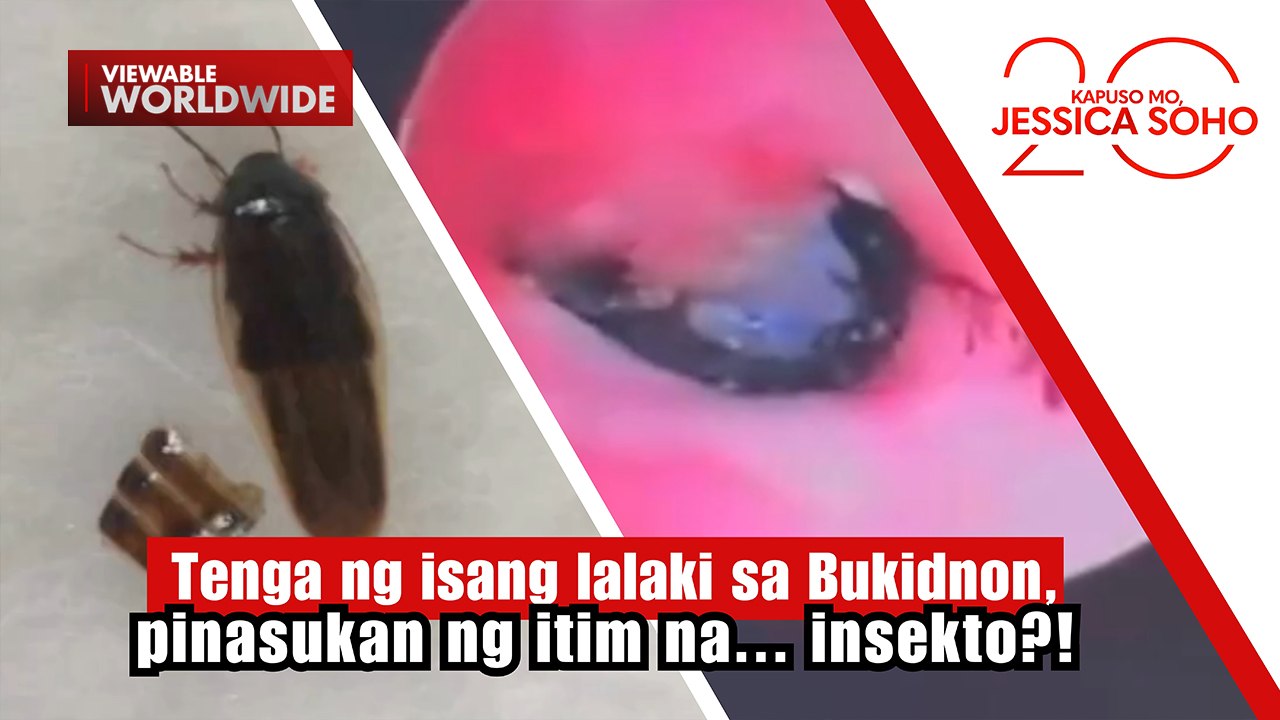 Tenga ng isang lalaki sa Bukidnon, pinasukan ng itim na... insekto ...