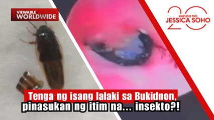 Tenga ng isang lalaki sa Bukidnon, pinasukan ng itim na... insekto?! | Kapuso Mo, Jessica Soho