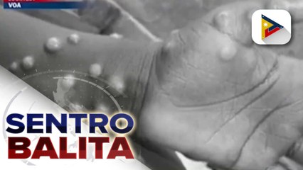DOH, nilinaw na hindi pa kinakailangang magpatupad ng lockdown dahil sa naitatalang kaso ng mpox sa ilang lugar sa Pilipinas