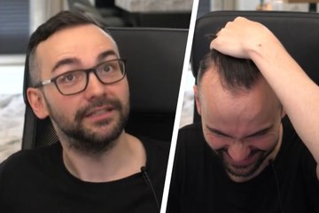 Xokas y su Secreto para Lucir Más Pelo 💇‍♂️