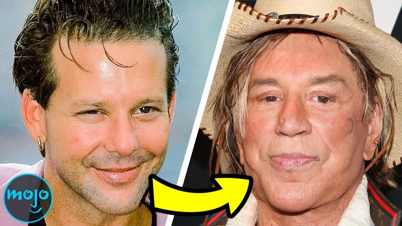 10 Celebrity Plastic Surgery Nightmares video Dailymotion