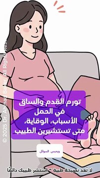 تورم القدم والساق في الحمل: الأسباب، الوقاية، ومتى تستشيرين الطبيب؟