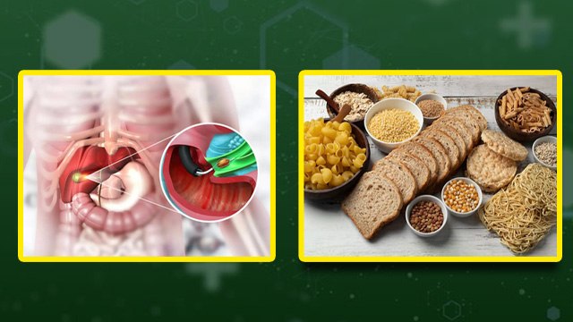 Foods To Avoid Eating After Gallbladder Removal: पित्त की थैली निकलवाने के बाद क्या नहीं खाना चाहिए
