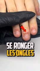 Comment Ronger Vos Ongles : Astuces et Solutions Efficaces ✨