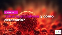 ¿Qué es el Linfoma y cómo detectarlo?