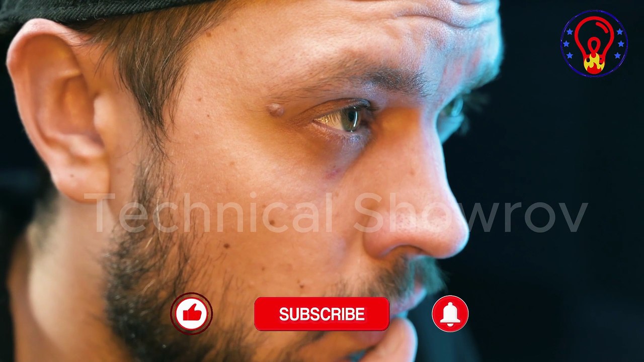 চোখ ঘষছেন ক্ষতি হয়ে যাচ্ছে না তো!