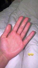 Duda Guerra revela sintomas após diagnóstico de condição de saúde; confira