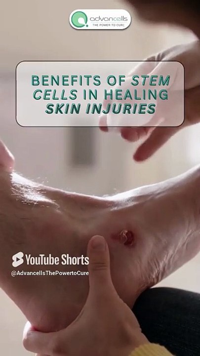 Faster Healing, Less Pain: The Power of Stem Cells in Recovery