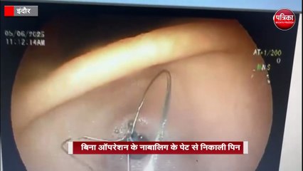 सरकारी डॉक्टरों ने कर दिया कमाल