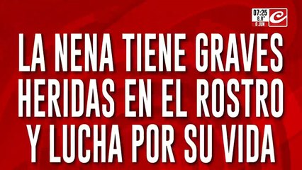 Pitbull atacó a una nena de un año: la dejó malherida y luchando por su vida