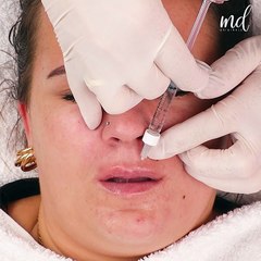 Pout perfection in progress! 💋