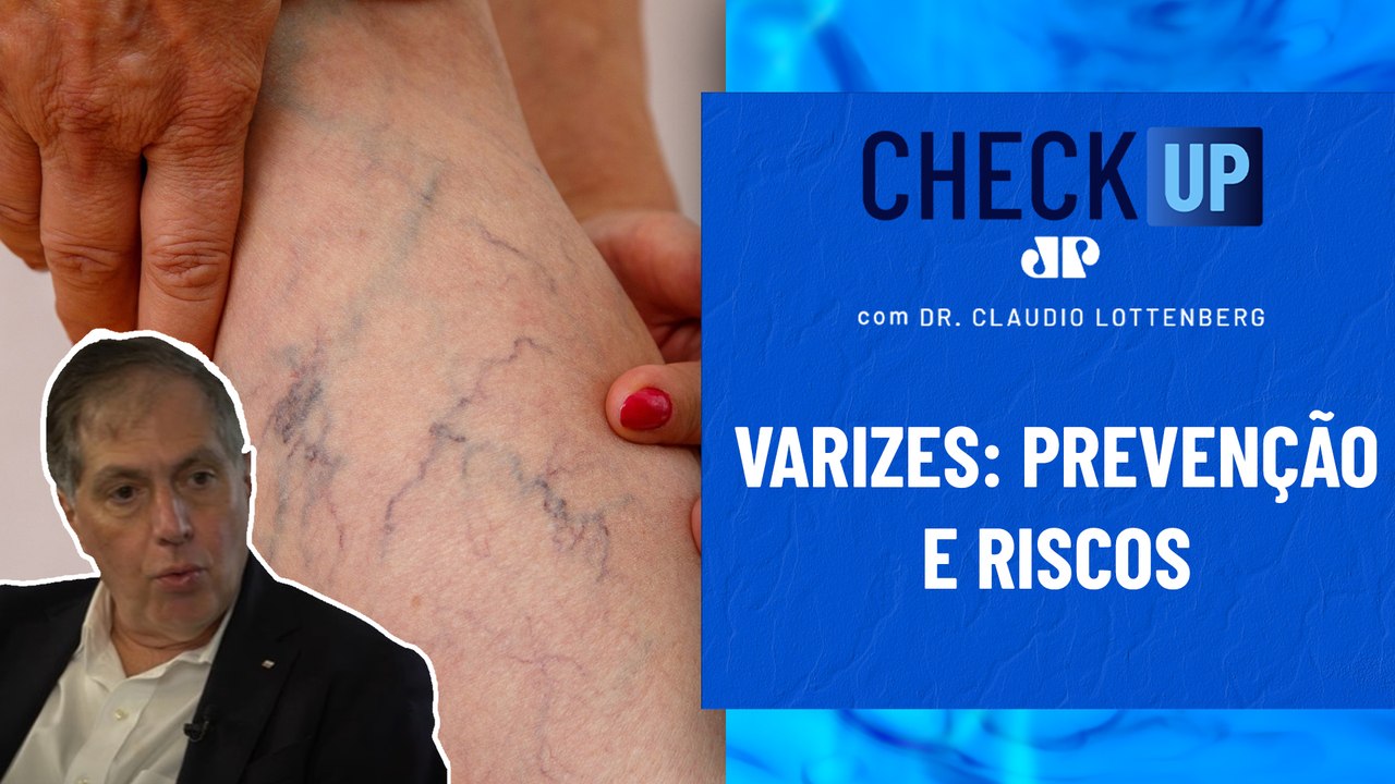 Qualquer pessoa pode ter varizes? Cirurgião vascular responde | CHECK UP