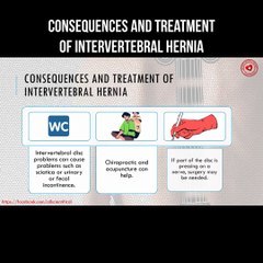 Consequences and treatment of intervertebral hernia