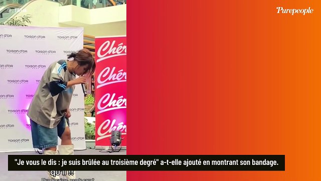 Amel Bent s'affiche avec un large bandage après avoir fait patienter son public, la chanteuse raconte ce qu'il s'est passé