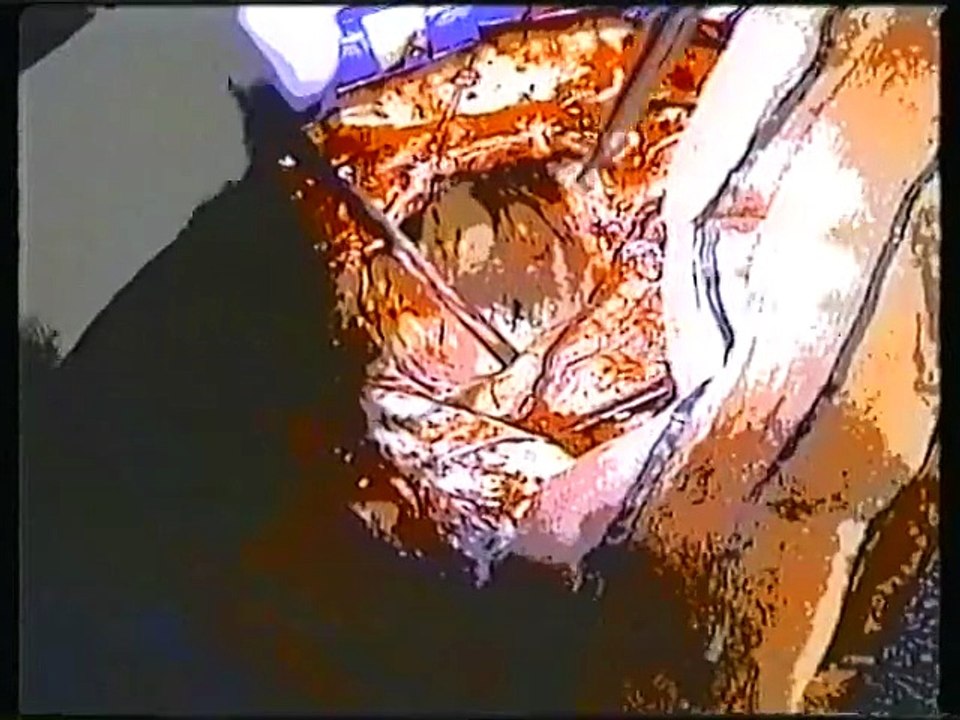 Dr. med Ben Carson - Begabte Hände - 1992 DT