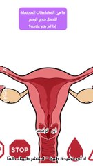 مضاعفات الحمل خارج الرحم: هل يمكن أن يهدد حياتك إذا لم يُعالج؟ الإجابة الصادمة هنا