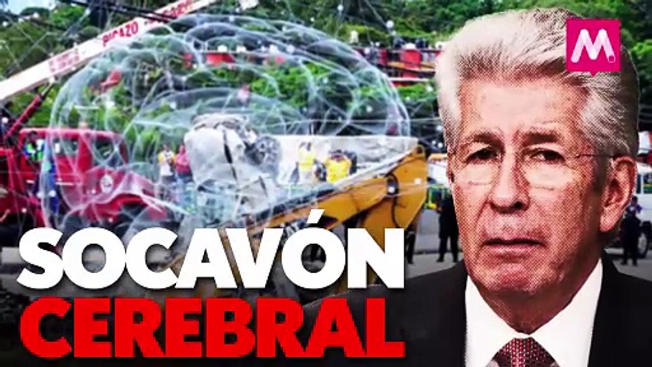 Socavón cerebral