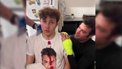 Fedez rompe il naso a Il Rosso durante un live su TikTok: «Comprami una Maserati»