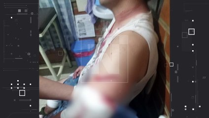 Médico es herido con un arma punzocortante en Pocona cuando iba a cenar