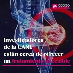 Buscan desarrollar bioimplantes económicos