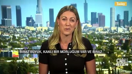 ABD polisinden gazeteciye plastik mermi... Avustralya'dan Los Angeles'taki görüntülere tepki geldi: Dehşet verici!