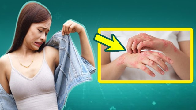 Fungal Infection: गर्मियों में फंगल इन्फेक्शन क्यों होता है,Treatment In Hindi | Boldsky