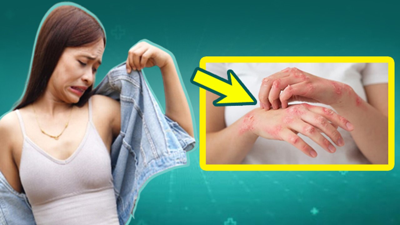 Fungal Infection: गर्मियों में फंगल इन्फेक्शन क्यों होता है,Treatment In Hindi | Boldsky