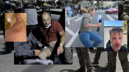 Los Angeles : plusieurs journalistes ciblés et blessés alors qu'ils couvraient les affrontements