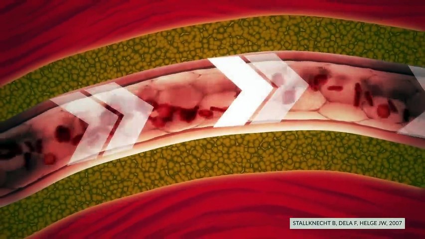 Targeting Belly Fat Is POSSIBLE! (New Study)