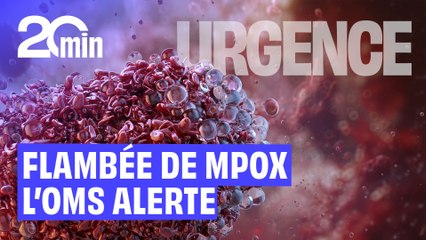 Mpox : L’OMS maintient son alerte mondiale face à la flambée des cas
