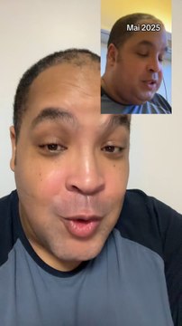 J’ai maigri, mon visage s’est affiné, mais la route est encore longue 😎 #diabete #diabetique# #obesite #transformation #avantapres #motivation #motivé #pertedepoids