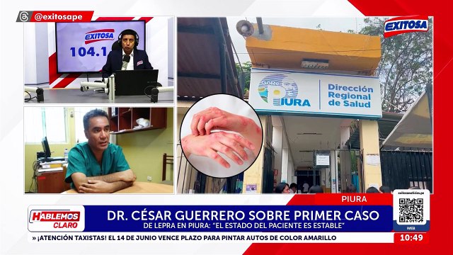 Alerta en Piura: Confirman primer caso de lepra y activan protocolo de atención y vigilancia epidemiológica