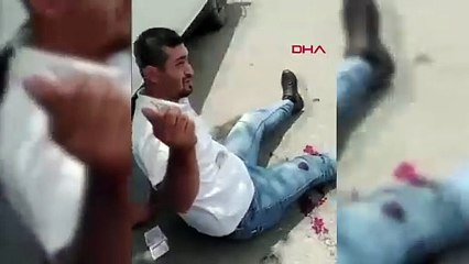 Malatyalı kadın kendisini rahatsız eden adamı ayaklarından vurdu