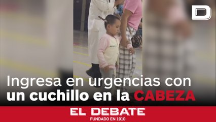 Una niña de tres años ingresa por su propio pie en urgencias con un cuchillo clavado en la cabeza