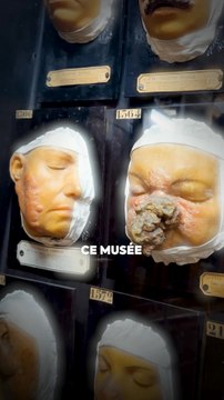 En 1867, un chirurgien de l’hôpital Saint‑Louis commande des moulages de peaux malades. Aujourd’hui, cette collection unique est exposée dans un musée pas comme les autres !🧑‍⚕️