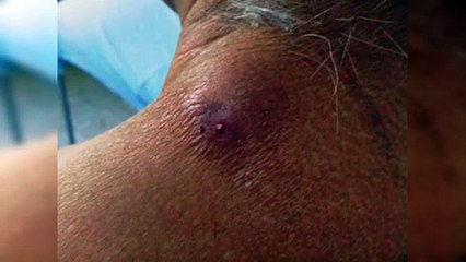 ¿Qué es el gusano barrenador y cómo se contagia?