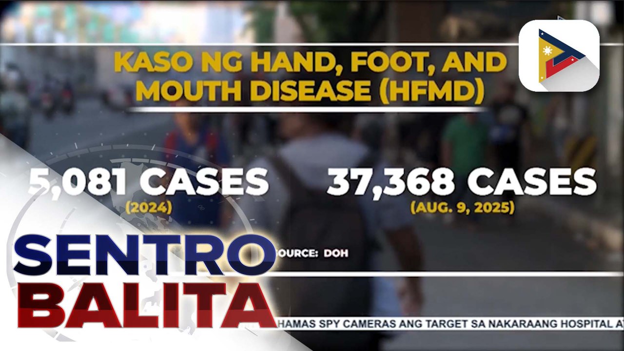 DOH, pinag-iingat ang publiko sa banta ng hand, foot, and mouth disease ngayong panahon ng tag-ulan | ulat ni Bien Manalo