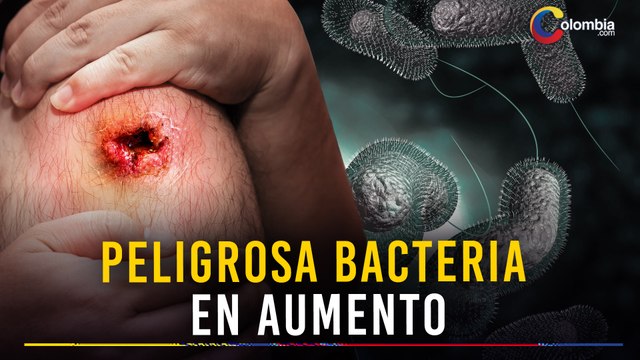 Estados Unidos en alerta máxima: aumenta el contagio de la peligrosa bacteria devoradora de carne