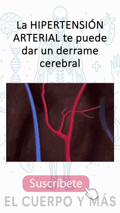 Shorts de hipertensión - Parte 6 #elcuerpoymas #hipertensión #salud #medicina