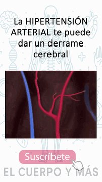 Shorts de hipertensión - Parte 6 #elcuerpoymas #hipertensión #salud #medicina