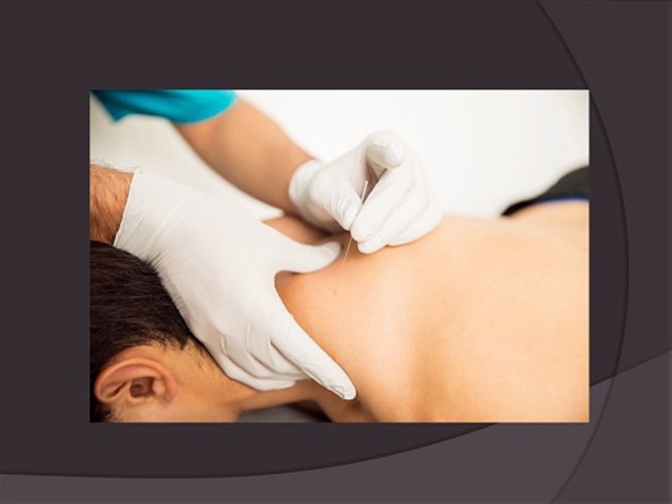 What Is Dry Needling Toronto and How Can It Relieve Your Pain?