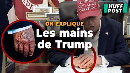 Les mains de Donald Trump relancent les spéculations sur l’état de santé du président américain