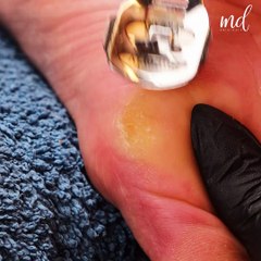 A much needed pedicure! 👣✨