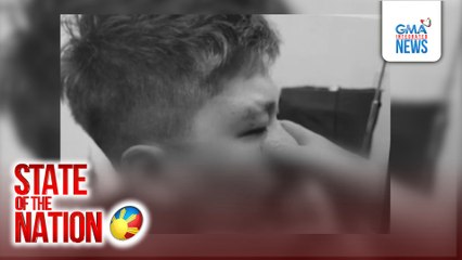 Babae, napuruhan sa mukha matapos tagain ng amain ng pinsan; suspek, tinutugis | SONA