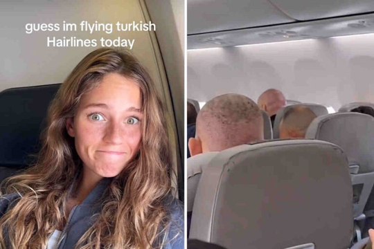 Video: Kadın yolcu, Türkiye'den dönen çok sayıda saç ekimi yaptırmış erkek görünce şoke oldu