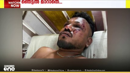 ആകാശദുരന്തത്തിൽ നിന്ന് അത്ഭുതകരമായി രക്ഷപ്പെട്ടെങ്കിലും ഞെട്ടൽ വിട്ടുമാറാതെ വിശ്വാസ് കുമാർ രമേശ്‌