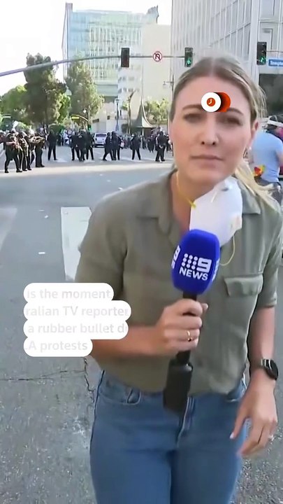 An Australian journalist was hit by a rubber bullet on June 8 while reporting live during protests in Los Angeles.