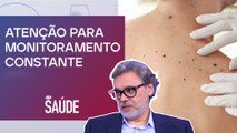 Qual impacto da genética e dos grupos de risco com câncer de pele | JP SAÚDE